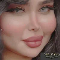 تزریق تخصصی ژل ومادلینگ وبوتاکس وهایفو|خدمات آرایشگری و زیبایی|کرمانشاه, |دیوار