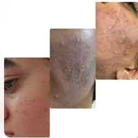 فیشال و پاکسازی پوست|خدمات آرایشگری و زیبایی|اصفهان, خواجو|دیوار