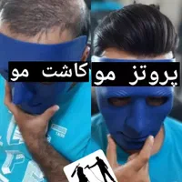پروتز مو و چسب پروتز مو شیراز|خدمات آرایشگری و زیبایی|شیراز, ملاصدرا|دیوار