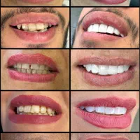 کلینیک دندانپزشکی دکتر دانشور|خدمات آرایشگری و زیبایی|شیراز, معالی‌آباد|دیوار
