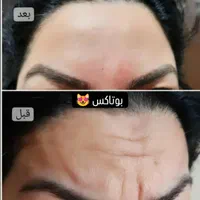 مژده ب همشهریان عزیزم آف چهل درصدی جراحی زیبایی|خدمات آرایشگری و زیبایی|دورود, |دیوار
