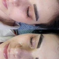 پاکسازی فیشال مزونیدلینگ اسکالپ کربوکسی پلکسر|خدمات آرایشگری و زیبایی|مشهد, رسالت|دیوار