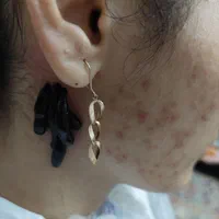 فصد تخصصی+پزشک، حجامت زالو، بوتاکس ژل مزوتراپی
