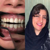 دندان پزشکی اقساطی ۱۲ماهه بدون پیش پرداخت|خدمات آرایشگری و زیبایی|تهران, خانی آباد نو شمالی|دیوار