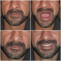 تعمیر و ساخت دندان‌های مصنوعی متحرک|خدمات آرایشگری و زیبایی|سمنان, |دیوار