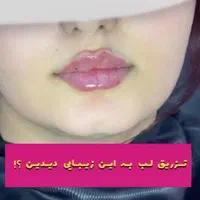 فیلر هایفو لاغری چربی لیزر پی آر پی مزو نخ|خدمات آرایشگری و زیبایی|تبریز, |دیوار