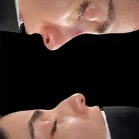 جراحی زیبائی بینی عمل بینی لیفت شقیقه پلک گوش غبغب|خدمات آرایشگری و زیبایی|اصفهان, مرداویج|دیوار