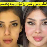 آموزش ژل و بوتاکس/لیفت نخ/لابیاپلاستی/ساکشن غبغب|خدمات آموزشی|تهران, فرمانیه|دیوار