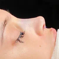 عمل جراحی زیبایی بینی و ترمیم بینی|خدمات آرایشگری و زیبایی|تهران, فلاح|دیوار