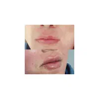 خدمات زیبایی اسلامشهر در منزل و کلینیک|خدمات آرایشگری و زیبایی|اسلام‌شهر, شهرک واوان|دیوار