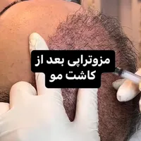 پی آر پی|خدمات آرایشگری و زیبایی|رشت, کاکتوس|دیوار