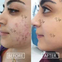 کرم سفید کننده ی عروس بندر|آرایشی، بهداشتی، درمانی|بندرعباس, |دیوار