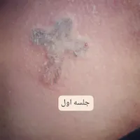 کارهای زیبایی.توسط،تکنسین مجرب|خدمات آرایشگری و زیبایی|مرودشت, ابوذر شمالی‎|دیوار