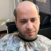 پروتز مو ، چسب پروتز ، ترمیم و تعویض چسب|خدمات آرایشگری و زیبایی|تبریز, |دیوار