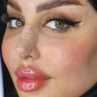 تخفیف ویژه پی ار پیprpفیلرژل بوتاکس کامپوزیت|خدمات آرایشگری و زیبایی|اهواز, کیان اباد|دیوار