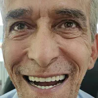 دندانسازی ،دندان مصنوعی،دندان،باضمانت وتحویل فوری|خدمات آرایشگری و زیبایی|مشهد, طلاب|دیوار
