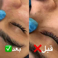 فیشال و خدمات تخصصی پوست توسط پیراپزشک در مطب پزشک|خدمات آرایشگری و زیبایی|مشهد, سجاد شهر|دیوار