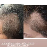 احیای دوباره ریشه مو با متد ارگانیک و گیاهی|خدمات آرایشگری و زیبایی|شیراز, زرهی|دیوار