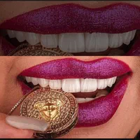دندانپزشکی/ ایمپلنت دیجیتال با وام قرض الحسنه