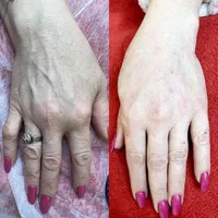 آف ژل*دست ، باسن ، هیپ دیپ و بیکینی *