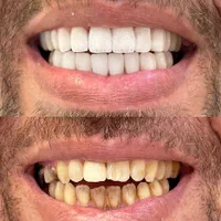دندانپزشکی/ایمپلنت/اقساطی/زیبایی/کامپوزیت|خدمات آرایشگری و زیبایی|تبریز, |دیوار