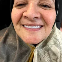 دندان مصنوعی + لابراتوار دندانسازی|خدمات آرایشگری و زیبایی|تهران, شهرک ولیعصر جنوبی|دیوار
