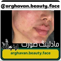 ژل و بوتاکس و آرایش دایم