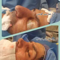 عمل جراحی بینی بامتخصص گوش،حلق،بینی|خدمات آرایشگری و زیبایی|تهران, ونک|دیوار