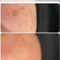 اپیلاسیون دائم،خالبرداری،لیفت ابرو،پارافین تراپی|خدمات آرایشگری و زیبایی|رشت, استقامت 2|دیوار