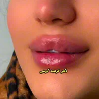 بوتاکس مصپورت فقط۴۹۰ کلینیک زیبایی دکتر فرشیدکریمی|خدمات آرایشگری و زیبایی|کرمانشاه, |دیوار