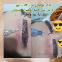 تزریق تخصصی ژل بوتاکس و جوانساز در مطب خانم دکتر|خدمات آرایشگری و زیبایی|سنندج, |دیوار
