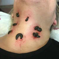 امبدینگ حجامت بادکش طب سوزنی فصد خون زالودرمانی|خدمات آرایشگری و زیبایی|اصفهان, سعادت‌آباد|دیوار