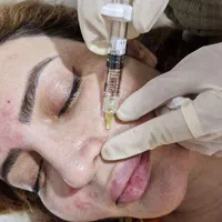 جشنواره ویژه هایفو تراپی  بوتاکس  بوتاکس زیر بغل|خدمات آرایشگری و زیبایی|تهران, نارمک|دیوار