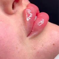 تزریق ژل جشنواره|خدمات آرایشگری و زیبایی|تهران, عبدل‌آباد|دیوار