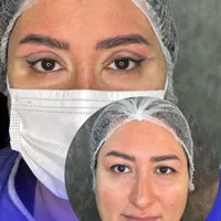 بلفاروپلاستی اتو پلاستی لیفت|خدمات آرایشگری و زیبایی|اهواز, نادری|دیوار