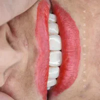 دندانپزشکی زیبایی-درمانی درمطب (خیابان جابرانصاری)|خدمات آرایشگری و زیبایی|اصفهان, میرعماد|دیوار