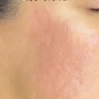 درمان تخصصی ،فیشال و اسیدتراپی و ماساژ درمانی صورت|خدمات آرایشگری و زیبایی|شیراز, رحمت‌آباد|دیوار