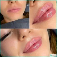 زیبایی کل صورت با سی سی 400|خدمات آرایشگری و زیبایی|اصفهان, شهشهان|دیوار