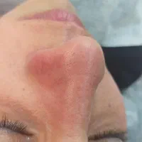 فشیال و پاکسازی تخصصی پوست|خدمات آرایشگری و زیبایی|اصفهان, عسگریه|دیوار