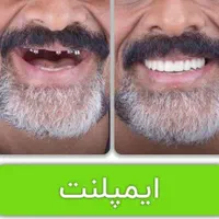 مرکز تخصصی ایمپلنت، مطب دندانپزشکی باقیمتی کم نظیر|خدمات آرایشگری و زیبایی|شیراز, قصرالدشت|دیوار