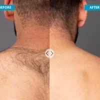 بوتاکس،فیلر،لیزر خانم و آقا،مزو،فیشال|خدمات آرایشگری و زیبایی|ری, دیلمان|دیوار