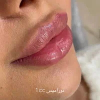 ژل و بوتاکس و پی آر پی
