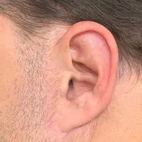 رفع و محو دو رنگی ویتیلیگو|خدمات آرایشگری و زیبایی|تهران, جوانمردان (اندیشه)|دیوار