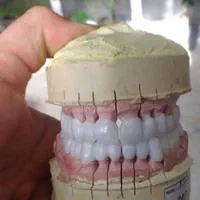 آموزش دندانپزشکی و کامپوزیت . لمینت .ترمیم|خدمات آموزشی|اسلام‌شهر, |دیوار