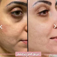 کلینیک لیزر و زیبایی دکتر اکرم درویش زاده|خدمات آرایشگری و زیبایی|زاهدان, |دیوار