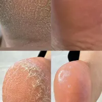 پدیکور روسی جدیدترین نوع کفسابی پا|خدمات آرایشگری و زیبایی|همدان, |دیوار