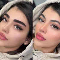 خدمات وآموزش میکروبلیدجدید سبک روسی در ایران