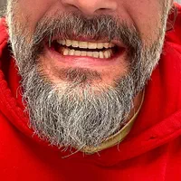 دندان مصنوعی(اقساطی)دندانسازی|خدمات آرایشگری و زیبایی|ارومیه, |دیوار