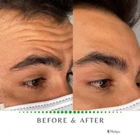 پاکسازی تخصصی پوست آقایان و بانوان