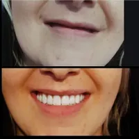 دندان مصنوعی|خدمات آرایشگری و زیبایی|اردبیل, |دیوار